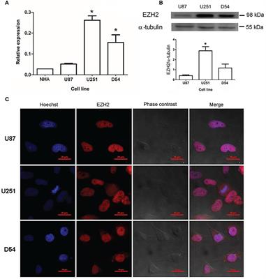 EZH2 Mediates Proliferation, Migration, and Invasion Promoted by Estradiol in Human Glioblastoma Cells